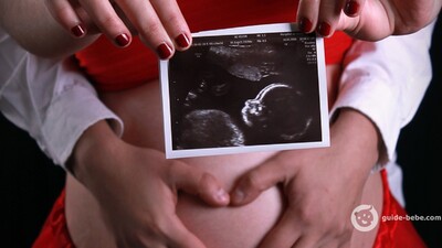 Echographie du bébé